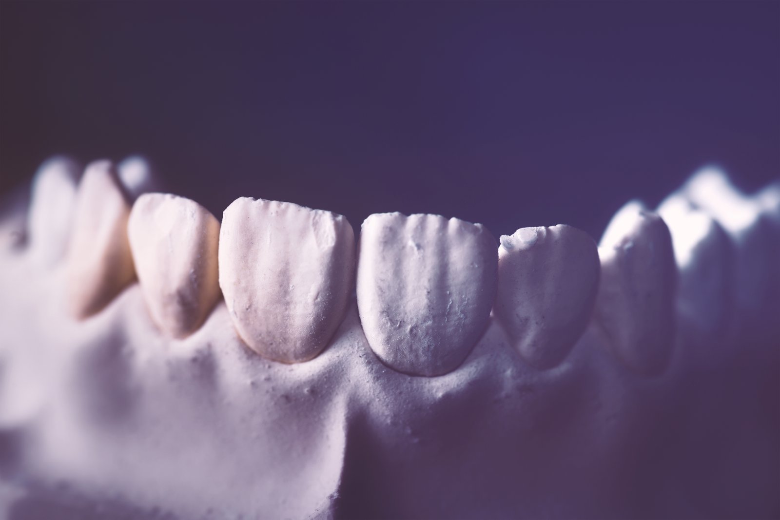 Dental instruments and prosthetic lab setup